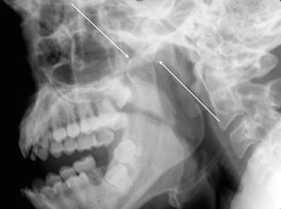 Jaw DISLOCATION COM AU